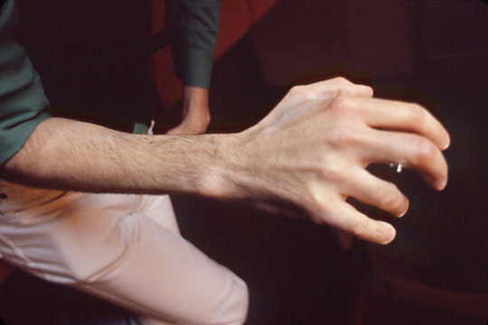 hand-2