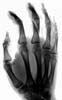 1-hand