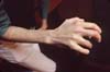 hand-2